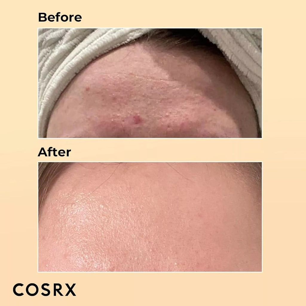 COSRX - Advanced Snail 96 Mucin Power Essence 100Ml -UK SELLER-