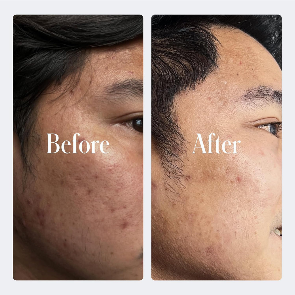 Retinol Anti-Aging Face Cream | Enhanced .2% Retinol Formula for Effective Results | Reduce Fine Lines & Wrinkles | Protect & Repair Skin with Hyaluronic Acid & Niacinamide | for Men & Women