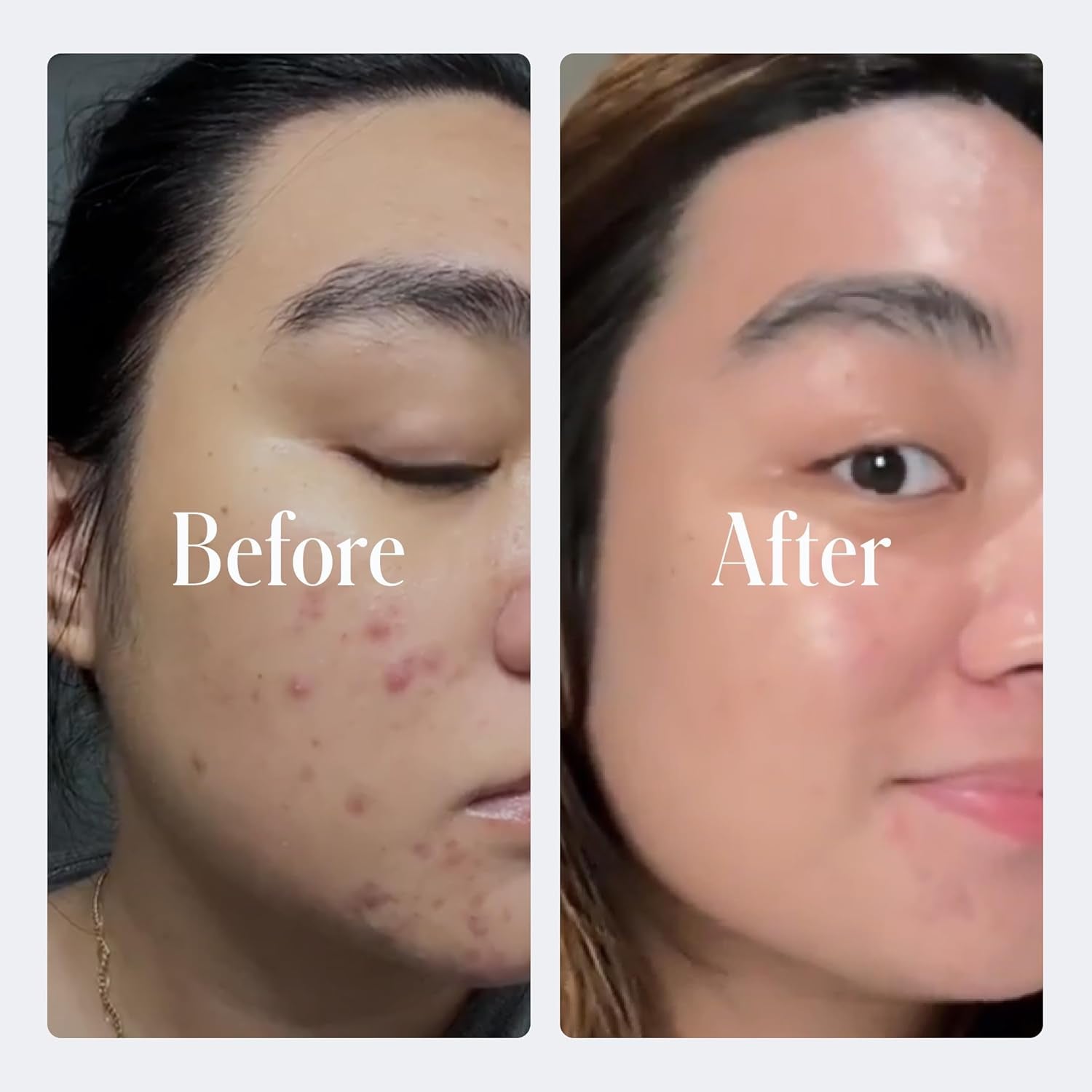 Retinol Anti-Aging Face Cream | Enhanced .2% Retinol Formula for Effective Results | Reduce Fine Lines & Wrinkles | Protect & Repair Skin with Hyaluronic Acid & Niacinamide | for Men & Women