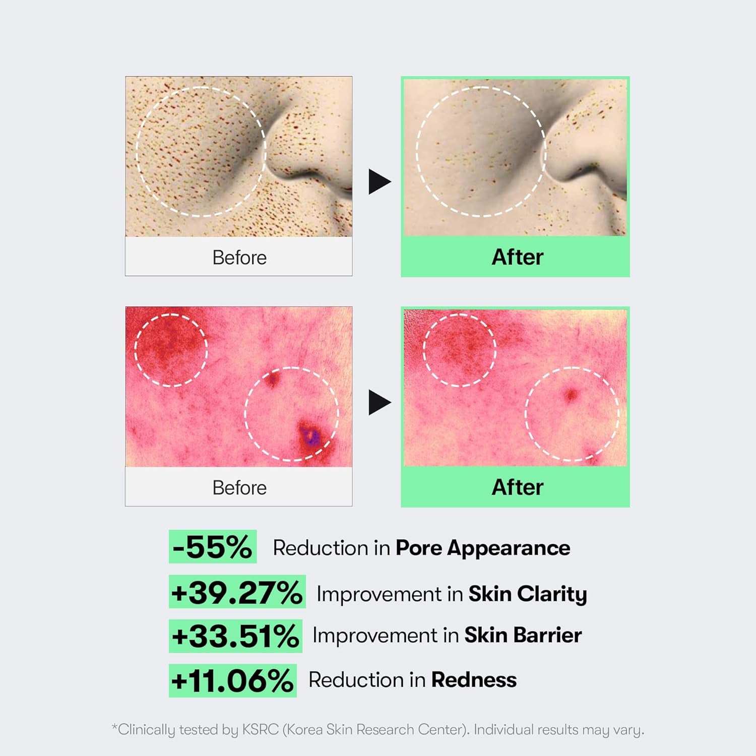 CICA Reedle Shot 100, Spicule Microneedling Serum for Pore Care & Exfoliation, Exosome, Centella Asiatica for Glass Skin, Skin Texture, Liquid Skin Booster, Korean Skin Care 50Ml