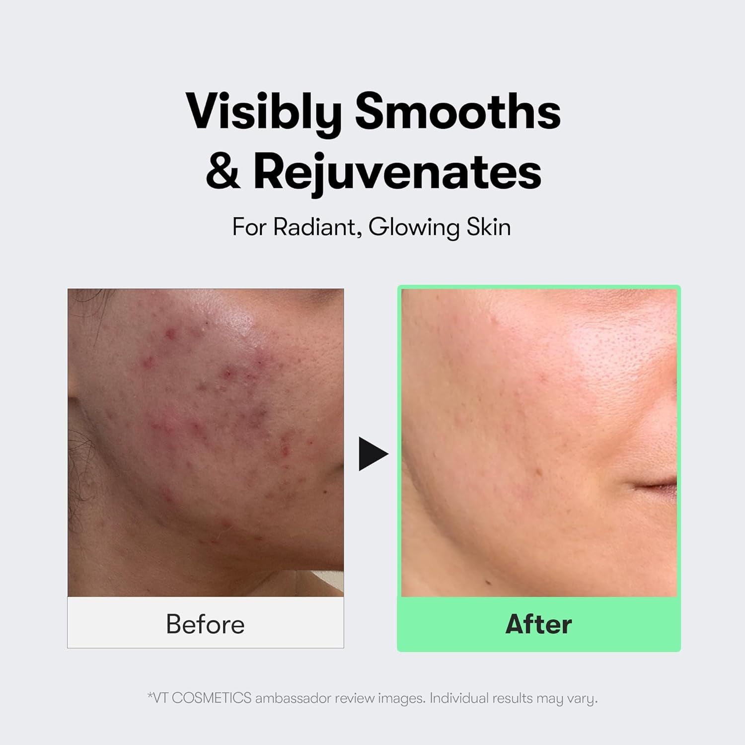 CICA Reedle Shot 100, Spicule Microneedling Serum for Pore Care & Exfoliation, Exosome, Centella Asiatica for Glass Skin, Skin Texture, Liquid Skin Booster, Korean Skin Care 50Ml